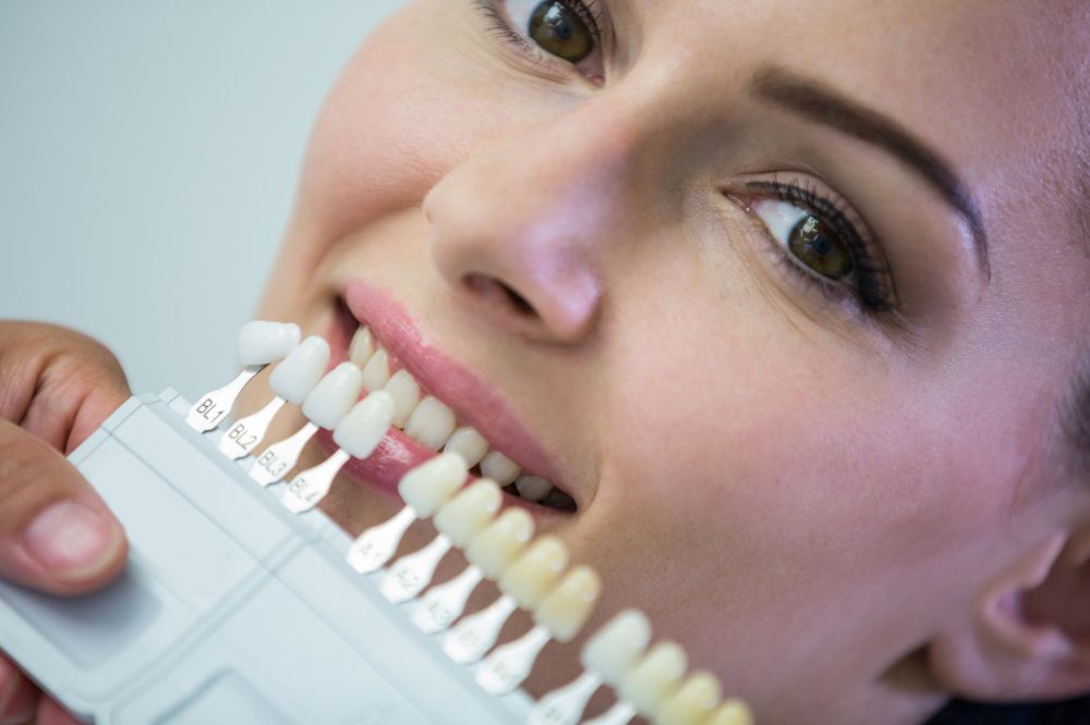 Sbiancamento e igiene dentale